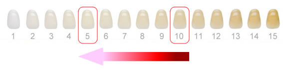 5段階程度歯の色が白くなります